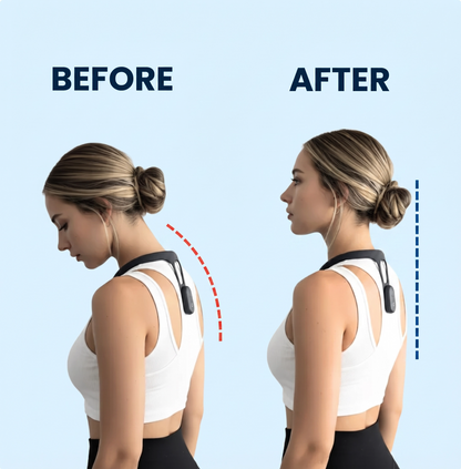 Smart Posture Corrector